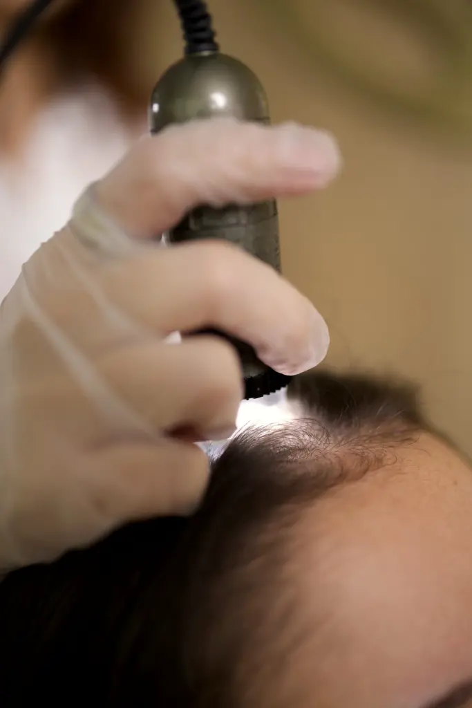 Mão de luva apoia o tricoscópio na linha do cabelo durante a análise do couro cabeludo